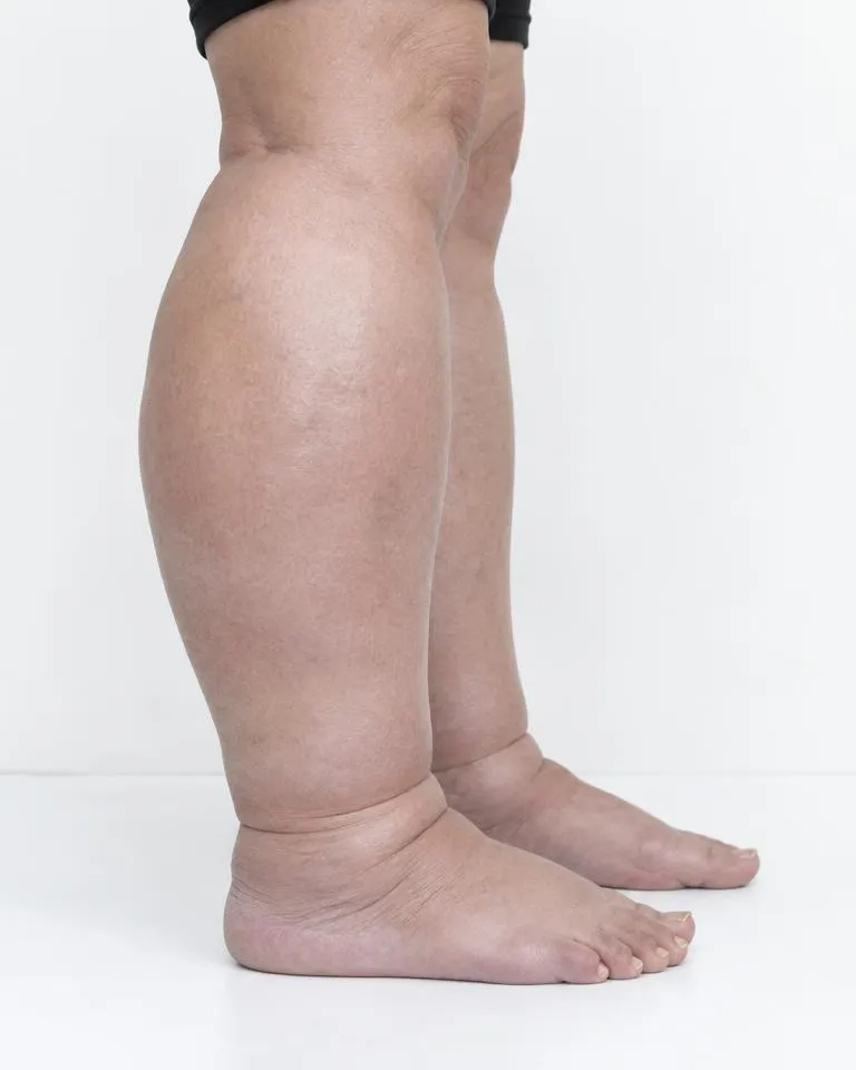 Before treatment